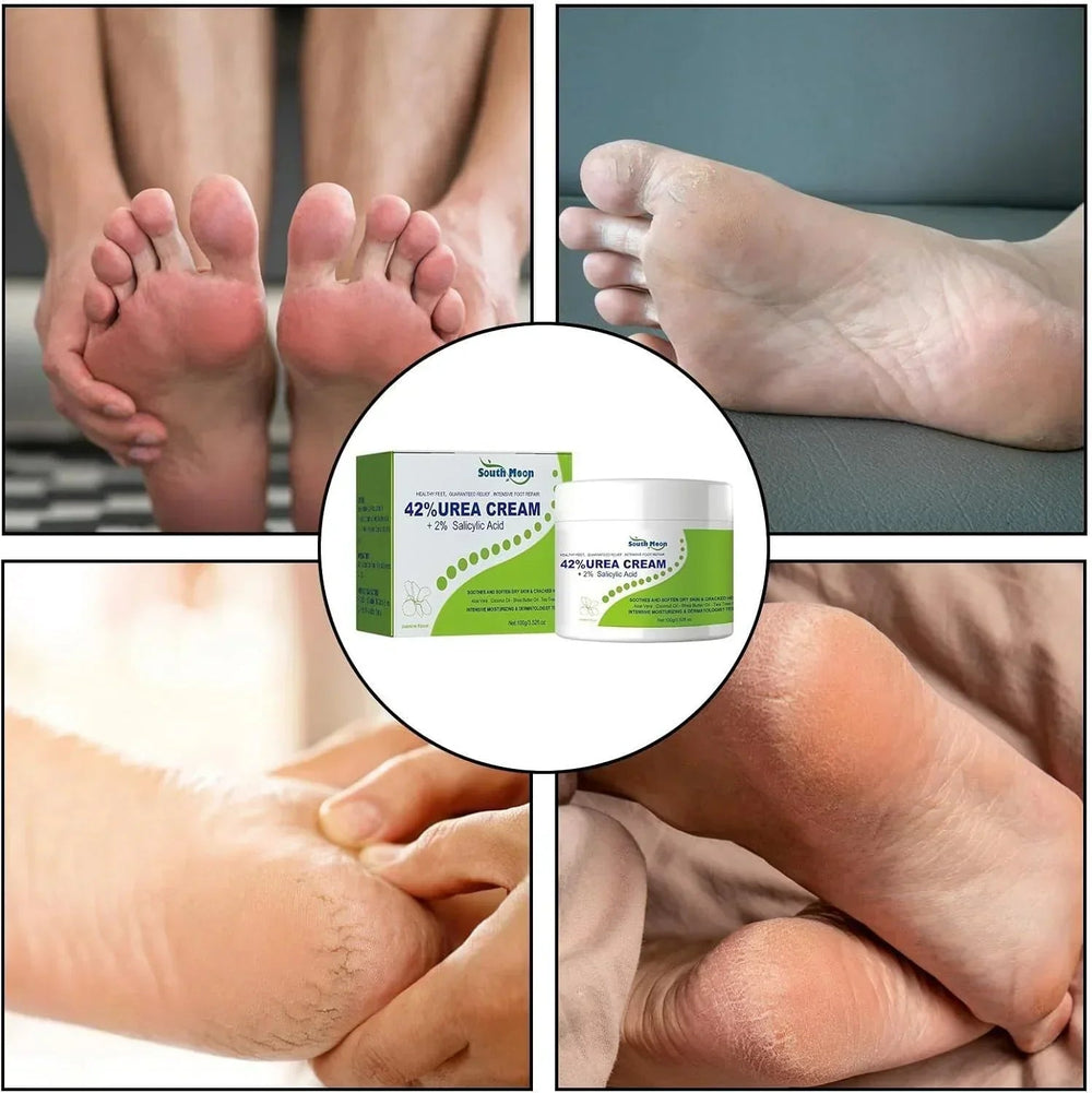 South Moon - 42% Urea Cream + 2% Salicylic Acid (Original) - Gulf Goods